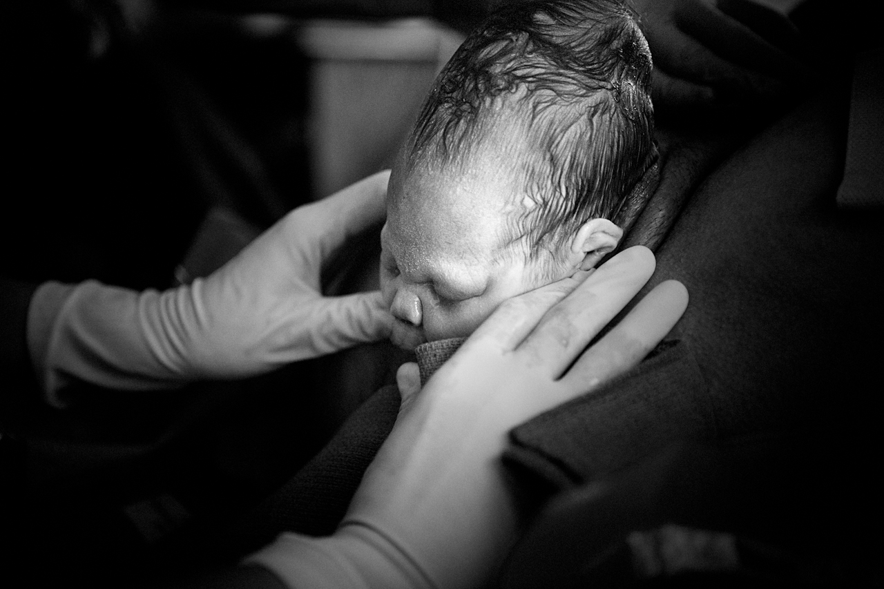 Baby emerging during child birth