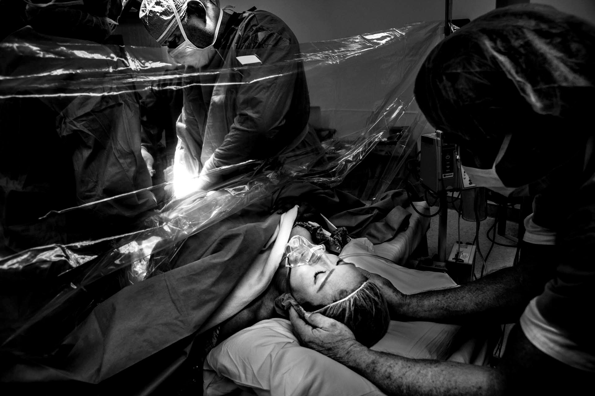 Black and white photo of a cesarean birth by Beverly Hills Birth photographer, Leona Darnell