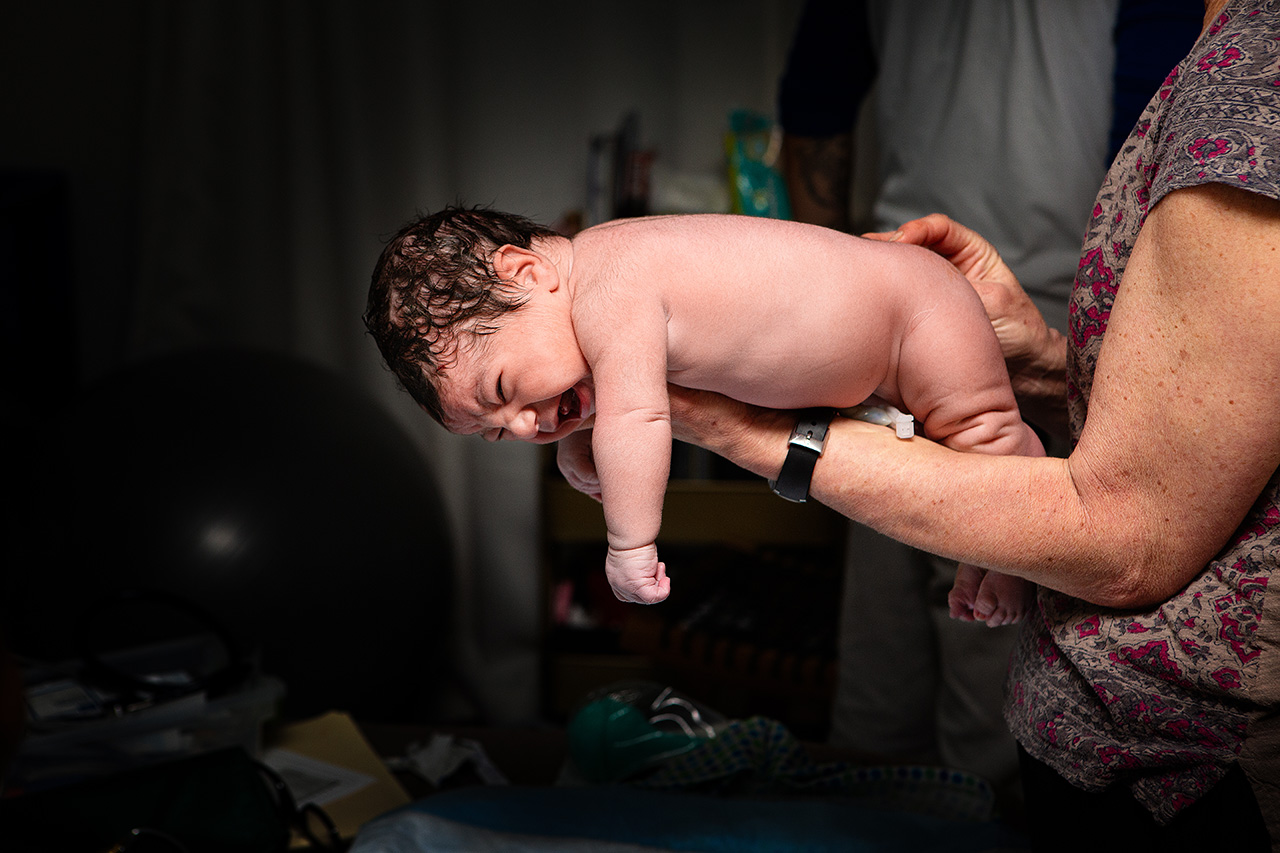 birth story image of a baby during a postpartum well baby check.