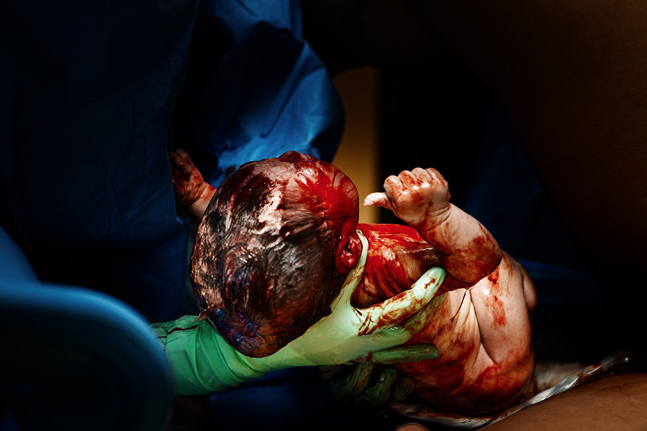 Birth photography image of a baby just born with blood on him by Los Angeles birth photographer and doula, Leona Darnell