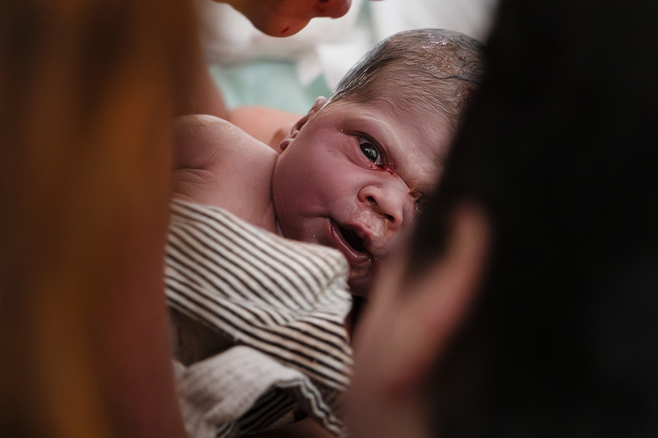 Birth photo of a baby looking directly at the camera after birth.