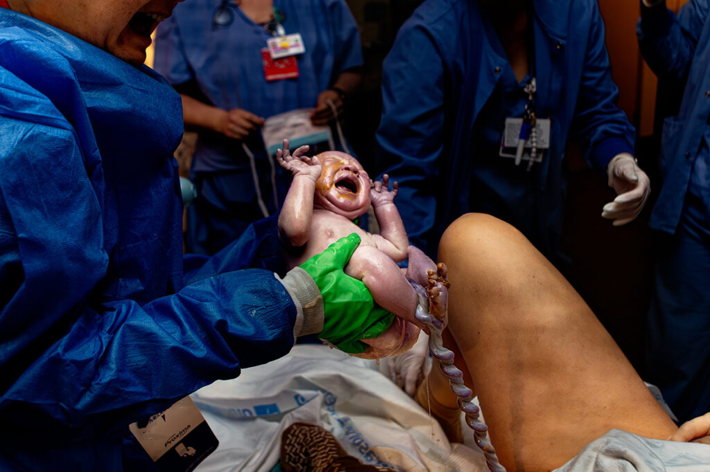 color birth photo by Leona Darnell showing a baby being born.