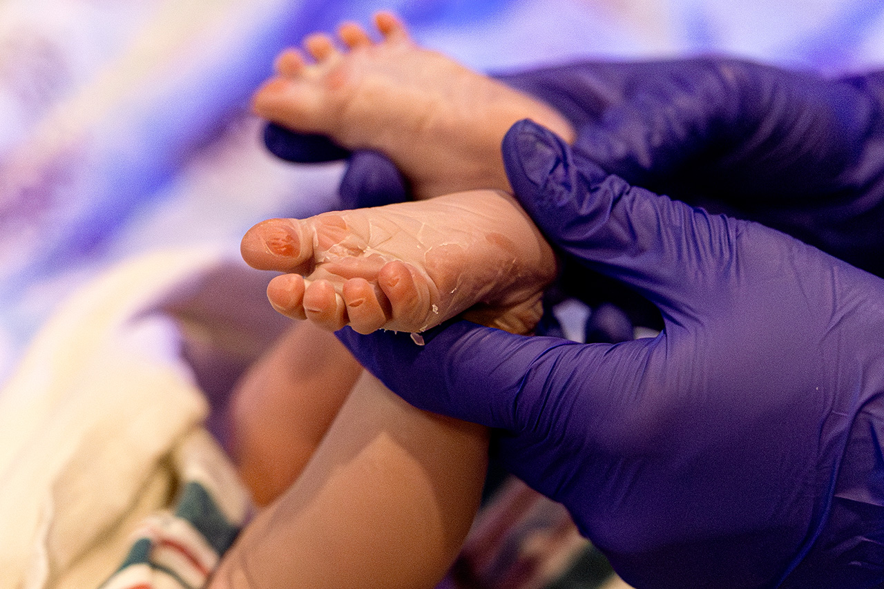 birth photography photo of tiny newborn does.