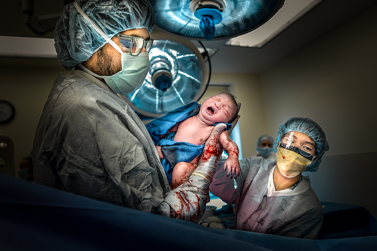 A cesarean birth image can make a dynamic impact. Photograph by Leona Darnell 